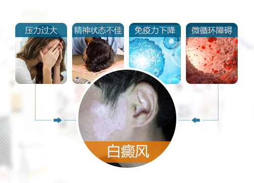 世界白癜风日帮女郎白癜风病案征集暨名医讲堂开课