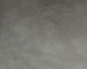 人пװߵ𣿶ͯʲô֢״
